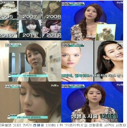 韩国一女子7年整容120次 叹割双眼皮待遇就不同